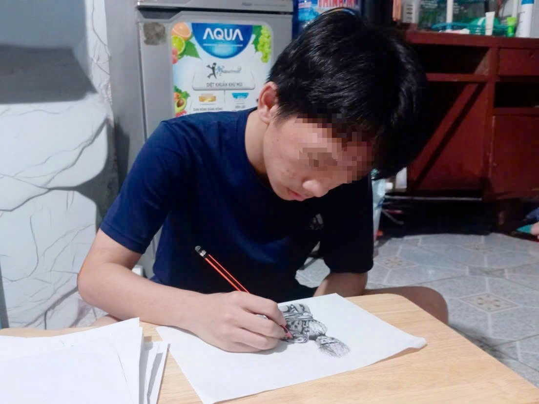 Cứu sống nam sinh h&ocirc;n m&ecirc; s&acirc;u do vỡ mạch m&aacute;u n&atilde;o- Ảnh 2.