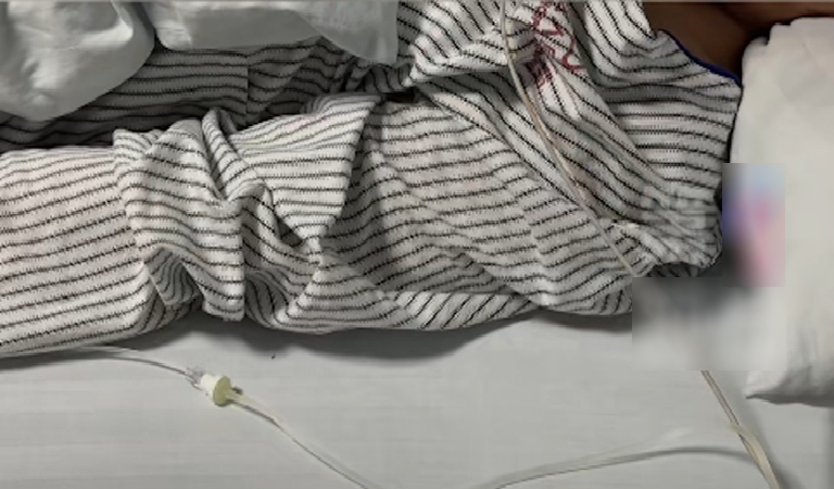 Ch&agrave;ng trai 30 tuổi mắt phải bỗng bị mờ, đi kh&aacute;m b&aacute;c sĩ kết luận: Hệ miễn dịch đ&atilde; bị tổn hại ho&agrave;n to&agrave;n- Ảnh 1.