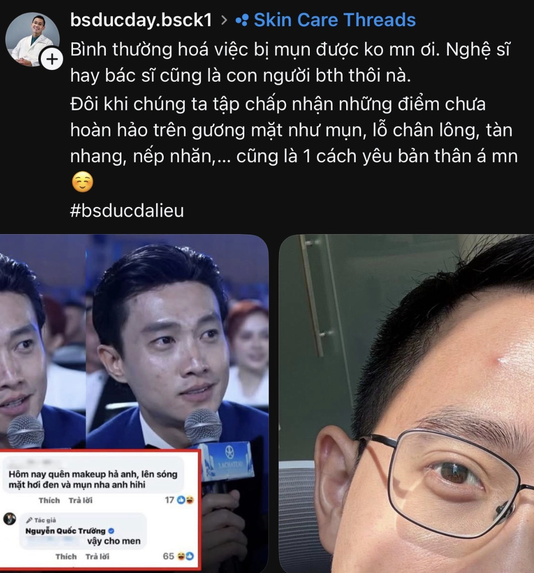 Bác sĩ da liễu nổi tiếng lên tiếng về mặt mụn của Quốc Trường- Ảnh 2. Bác sĩ da liễu nổi tiếng lên tiếng về mặt mụn của Quốc Trường- Ảnh 2.