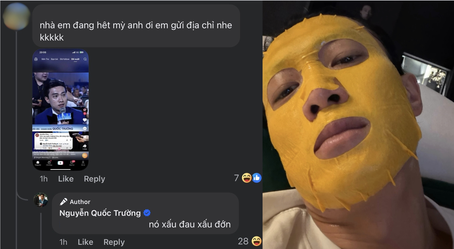 Bác sĩ da liễu nổi tiếng lên tiếng về mặt mụn của Quốc Trường- Ảnh 4. Bác sĩ da liễu nổi tiếng lên tiếng về mặt mụn của Quốc Trường- Ảnh 4.