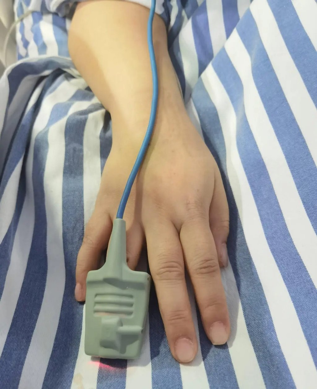 C&ocirc; g&aacute;i nguy kịch khi nhập viện cấp cứu nhưng kh&ocirc;ng thể lắp m&aacute;y hỗ trợ v&igrave; bộ m&oacute;ng &uacute;p- Ảnh 2.