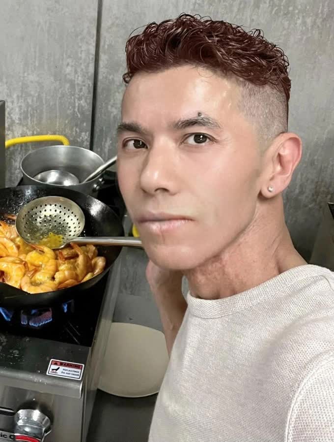 Những ng&agrave;y cuối đời của ca sĩ Kasim Ho&agrave;ng Vũ: Khu&ocirc;n mặt biến dạng do bệnh u xương h&agrave;m, bế tắc v&igrave; chi ph&iacute; chữa trị h&agrave;ng tỷ đồng- Ảnh 4.