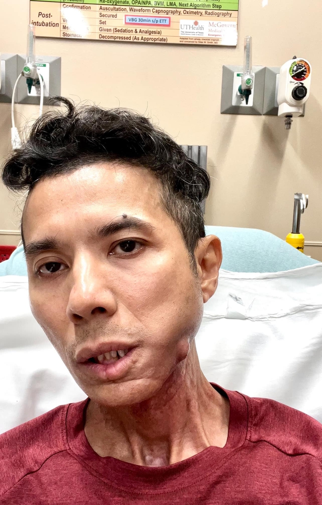 Nam ca sĩ Việt vừa qua đời: Qu&aacute;n qu&acirc;n Sao Mai, gương mặt biến dạng v&igrave; bạo bệnh- Ảnh 5.