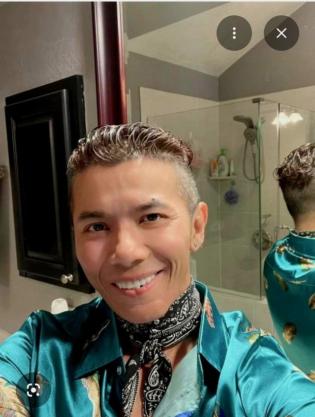 Từ căn bệnh của Kasim Ho&agrave;ng Vũ, b&aacute;c sĩ cảnh b&aacute;o: Kh&ocirc;ng chủ quan khi c&oacute; dấu hiệu n&agrave;y tại v&ugrave;ng miệng- Ảnh 1.