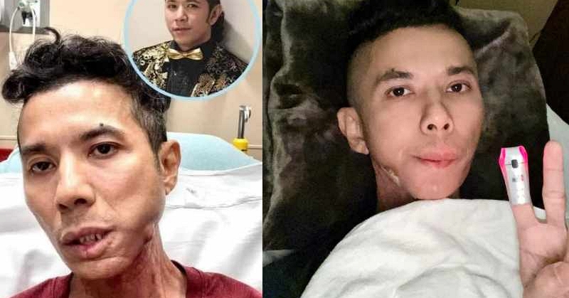 Chi ph&iacute; điều trị bệnh của Kasim Ho&agrave;ng Vũ b&ecirc;n Mỹ 