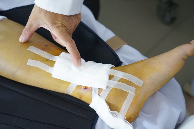 Cứu nam t&agrave;i xế c&ocirc;ng nghệ đa chấn thương nặng sau tai nạn tr&ecirc;n đường Phạm Ngũ L&atilde;o- Ảnh 1.