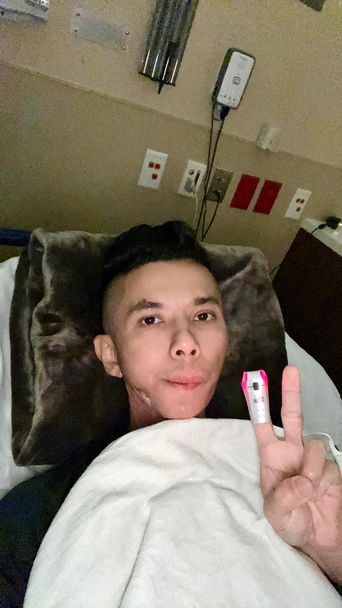 Những ng&agrave;y cuối đời của ca sĩ Kasim Ho&agrave;ng Vũ: Khu&ocirc;n mặt biến dạng do bệnh u xương h&agrave;m, bế tắc v&igrave; chi ph&iacute; chữa trị h&agrave;ng tỷ đồng- Ảnh 2.