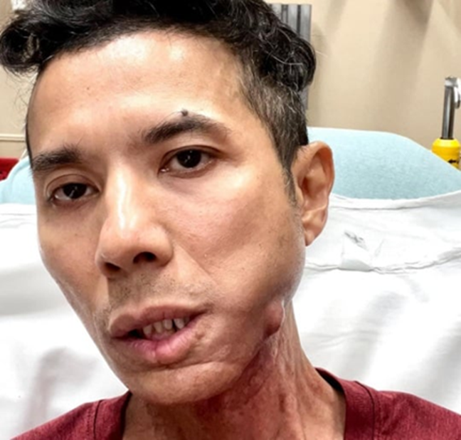 Kasim Ho&agrave;ng Vũ qua đời v&igrave; 1 căn bệnh dễ bị bỏ qua: Triệu chứng ban đầu mờ nhạt, những ai cần đặc biệt cảnh gi&aacute;c?- Ảnh 1.