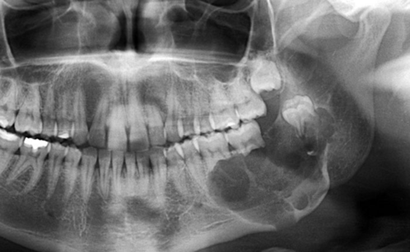 Kasim Ho&agrave;ng Vũ qua đời v&igrave; 1 căn bệnh dễ bị bỏ qua: Triệu chứng ban đầu mờ nhạt, những ai cần đặc biệt cảnh gi&aacute;c?- Ảnh 2.