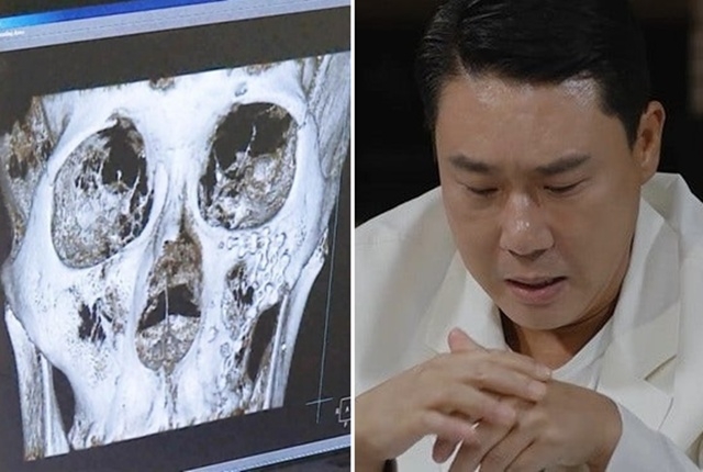 &ldquo;Anh sếp showbiz&rdquo; v&agrave; 2 ca sĩ ẩu đả kinh ho&agrave;ng trong qu&aacute;n nhậu, v&igrave; tiếc chiếc đồng hồ đắt tiền m&agrave; bị đấm t&uacute;i bụi v&agrave;o mặt- Ảnh 2.