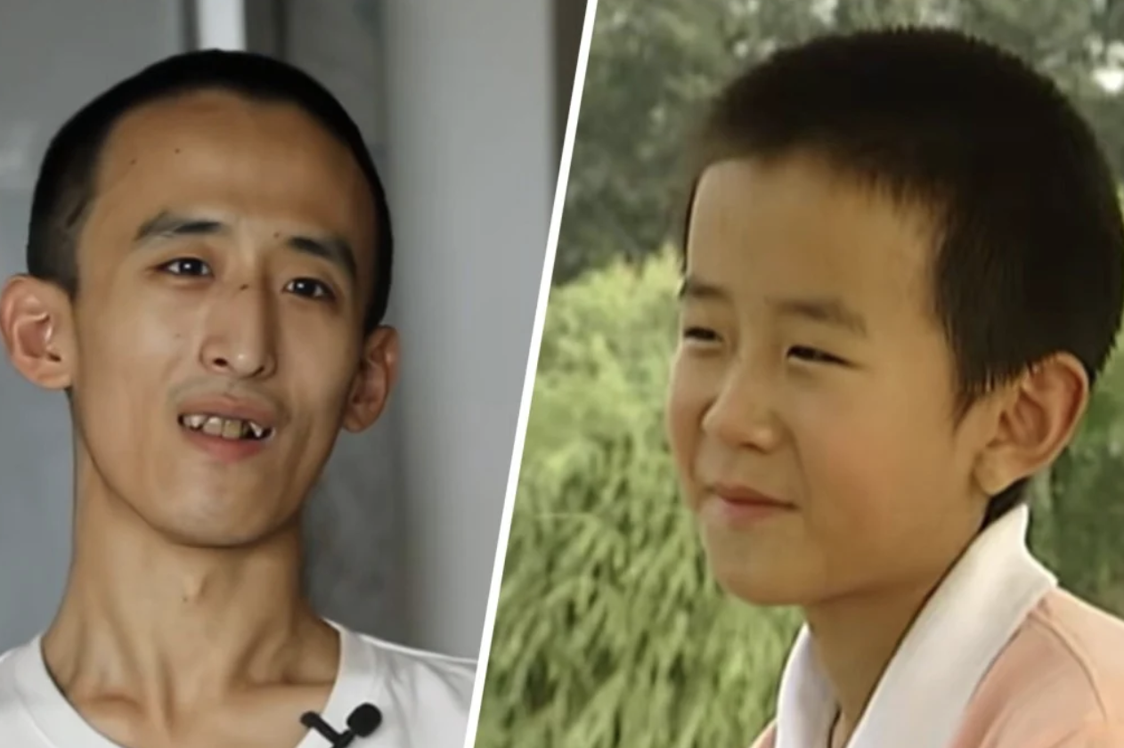 Thần đồng 10 tuổi v&agrave;o đại học, 16 tuổi lấy bằng Tiến sĩ: Nay thất nghiệp, sống "ăn b&aacute;m bố mẹ"- Ảnh 1.