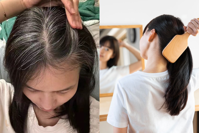 Nhiều người chưa 30 tuổi đ&atilde; bạc t&oacute;c: 3 nh&oacute;m người dễ c&oacute; t&oacute;c bạc nhất v&agrave; 3 c&aacute;ch đơn giản gi&uacute;p t&oacute;c đen l&acirc;u hơn- Ảnh 1.