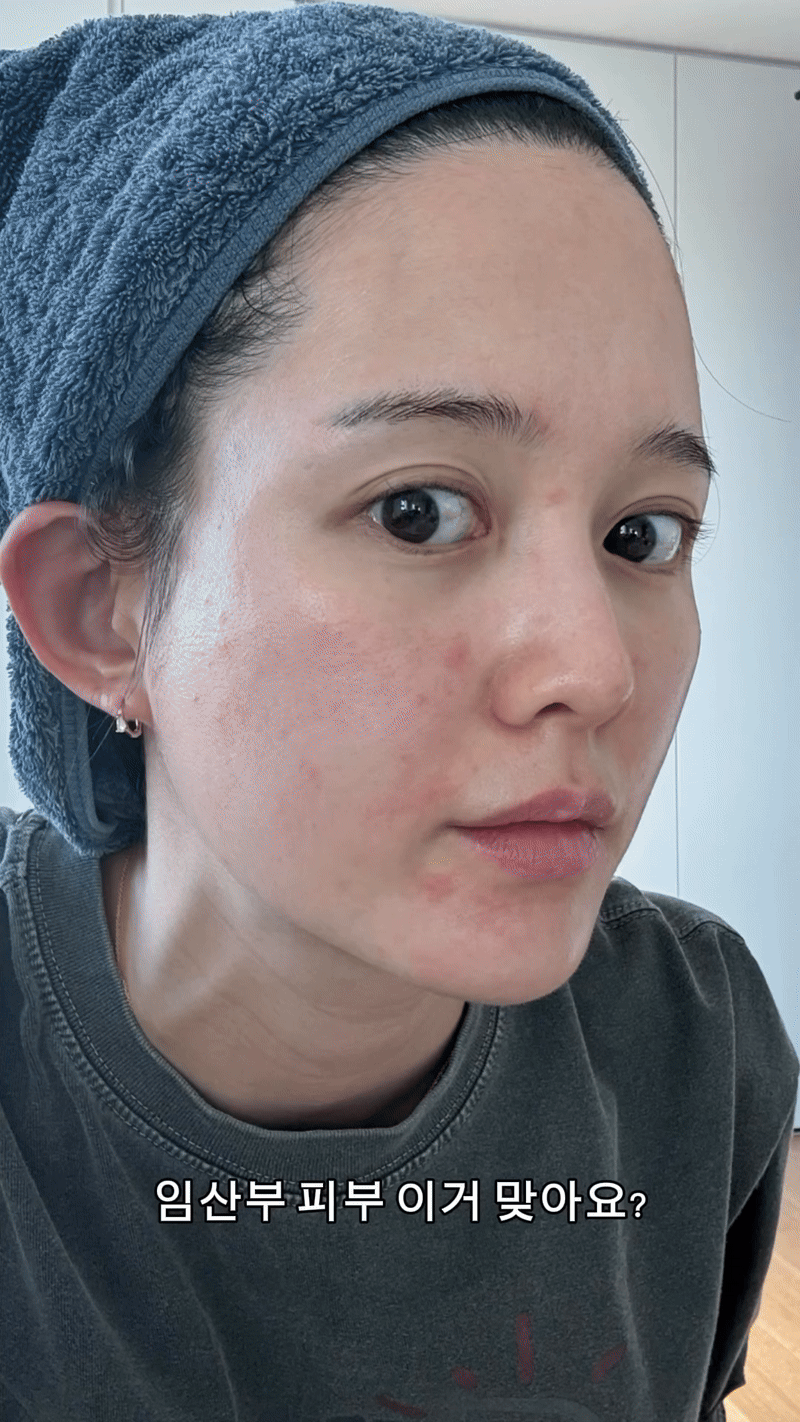 Mỹ nh&acirc;n Mặt Trăng &Ocirc;m Mặt Trời nguy cơ bị ung thư ngay trước ng&agrave;y cưới- Ảnh 3.