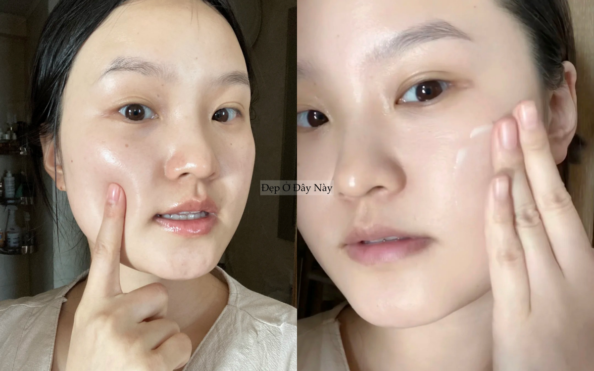 Tạm biệt da dầu b&oacute;ng nhẫy, c&ocirc; n&agrave;ng n&agrave;y t&igrave;m ra c&aacute;ch khiến da r&aacute;o mịn v&agrave; ngừa l&atilde;o h&oacute;a- Ảnh 4.