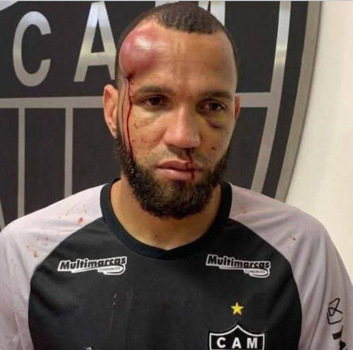 Trận đấu bạo lực nhất lịch sử b&oacute;ng đ&aacute; Brazil với 23 thẻ đỏ- Ảnh 1.