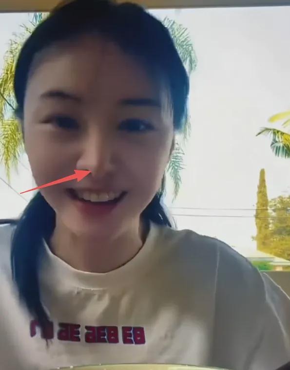 Kh&oacute; tin nổi đ&acirc;y l&agrave; Trịnh Sảng sau khi &ldquo;dao k&eacute;o&rdquo; to&agrave;n bộ gương mặt- Ảnh 6.