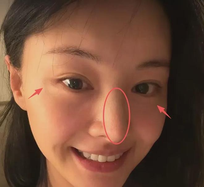 Kh&oacute; tin nổi đ&acirc;y l&agrave; Trịnh Sảng sau khi &ldquo;dao k&eacute;o&rdquo; to&agrave;n bộ gương mặt- Ảnh 5.