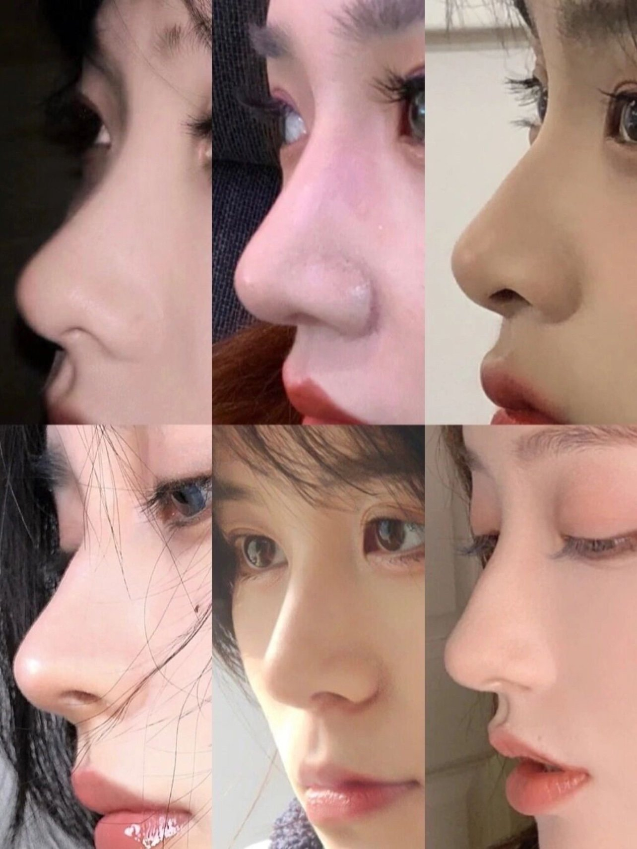 "Mũi gồ bay" v&agrave; cuộc lật đổ thầm lặng của chuẩn đẹp Ch&acirc;u &Aacute;, đến đ&agrave;n &ocirc;ng cũng phải xếp h&agrave;ng "độ nhan"- Ảnh 5.