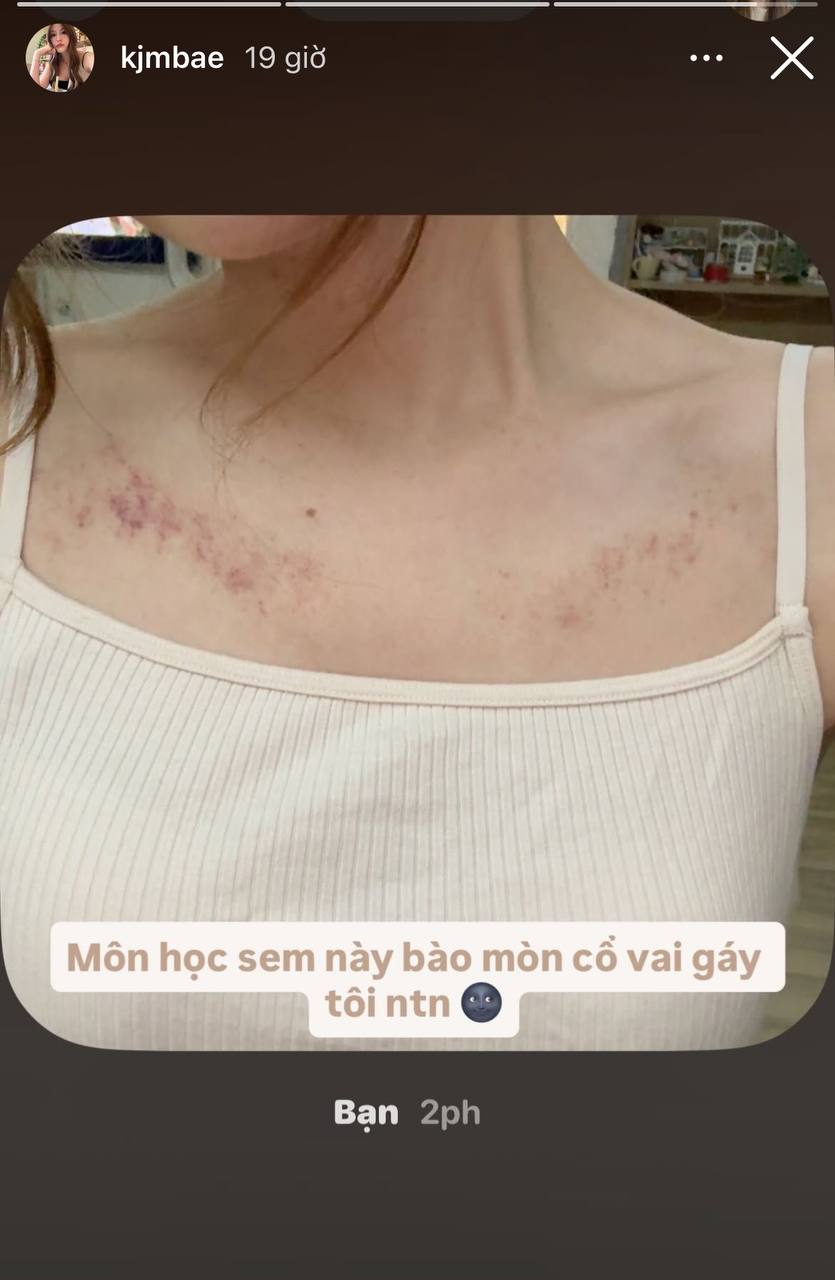 HIEUTHUHAI v&agrave; Tăng Mỹ H&agrave;n chuyển địa điểm hẹn h&ograve;, lần n&agrave;y l&agrave; trị liệu xương khớp- Ảnh 2.