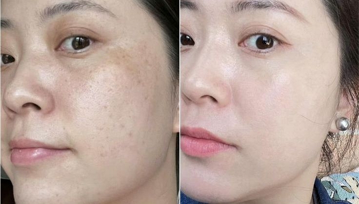 Cảnh b&aacute;o gấp d&agrave;nh cho những gia đ&igrave;nh đang d&ugrave;ng thớt gỗ - Ảnh 1.