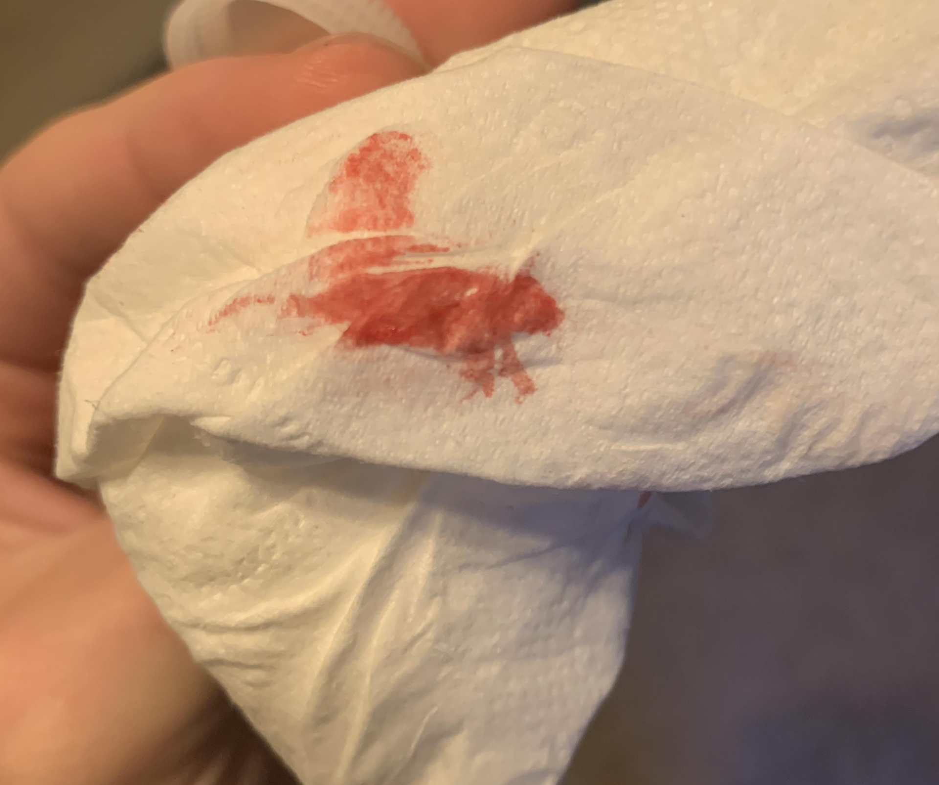 Nam sinh 17 tuổi khám nghẹt mũi lộ ra khối u "ăn" hộp sọ, bác sĩ nhắc: "Có 3 dấu hiệu phải đến bệnh viện ngay" - Ảnh 4.