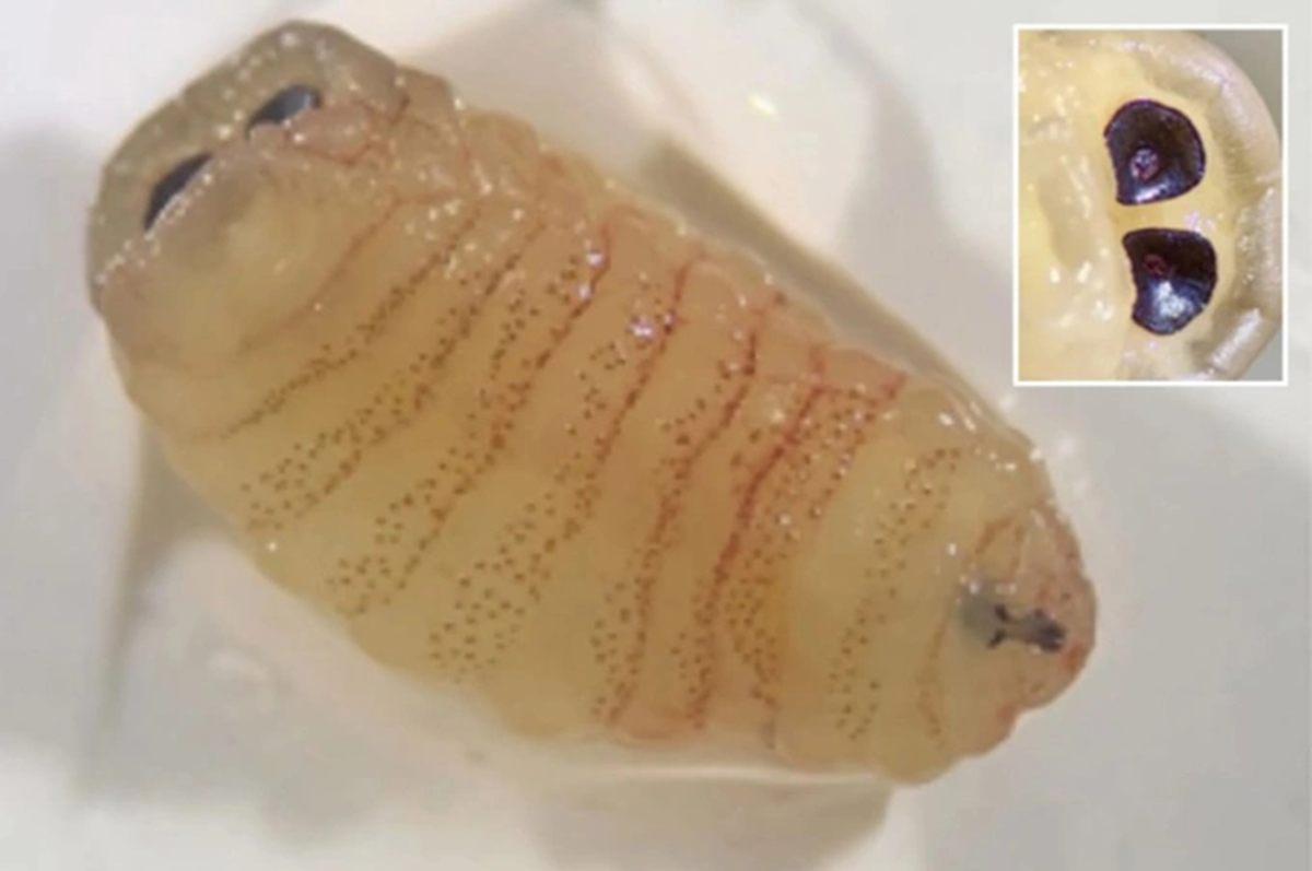 Người phụ nữ 58 tuổi "sốc" khi hắt hơi ra h&agrave;ng loạt gi&ograve;i sống - Ảnh 1.