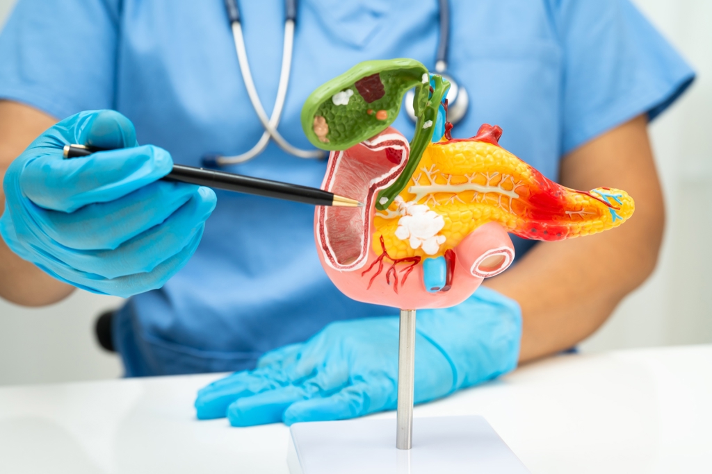 Khi ung thư &ldquo;g&otilde; cửa&rdquo;, 3 thứ n&agrave;y của cơ thể c&oacute; thể đổi m&agrave;u- Ảnh 1.