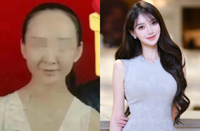 Hoa kh&ocirc;i sinh con cho Huỳnh Hiểu Minh &ldquo;dao k&eacute;o&rdquo; 100% cơ thể, xem diện mạo trước chỉnh sửa m&agrave; sốc nặng- Ảnh 4.