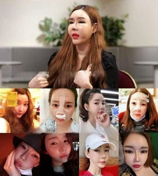 Sao chuyển giới chi 2,5 tỷ "dao k&eacute;o" to&agrave;n bộ gương mặt, 2 lần chia tay bạn trai trong nước mắt v&igrave; kh&ocirc;ng thể sinh con- Ảnh 1.