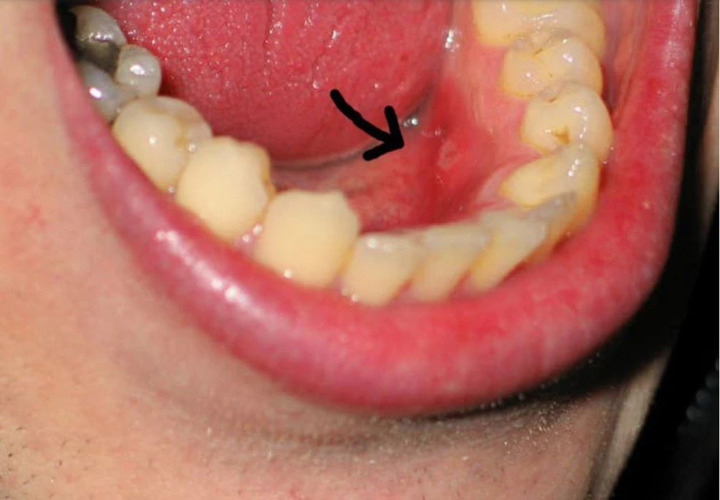 3 căn bệnh nguy hiểm nhưng 'ngụy trang tinh vi', kh&oacute; ph&aacute;t hiện sớm- Ảnh 1.