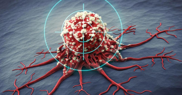 Một năm trước khi mắc ung thư dạ d&agrave;y, cơ thể sẽ ph&aacute;t ra 4 dấu hiệu cảnh b&aacute;o, kh&ocirc;ng may l&agrave; 80% người bệnh lại bỏ qua - Ảnh 3.