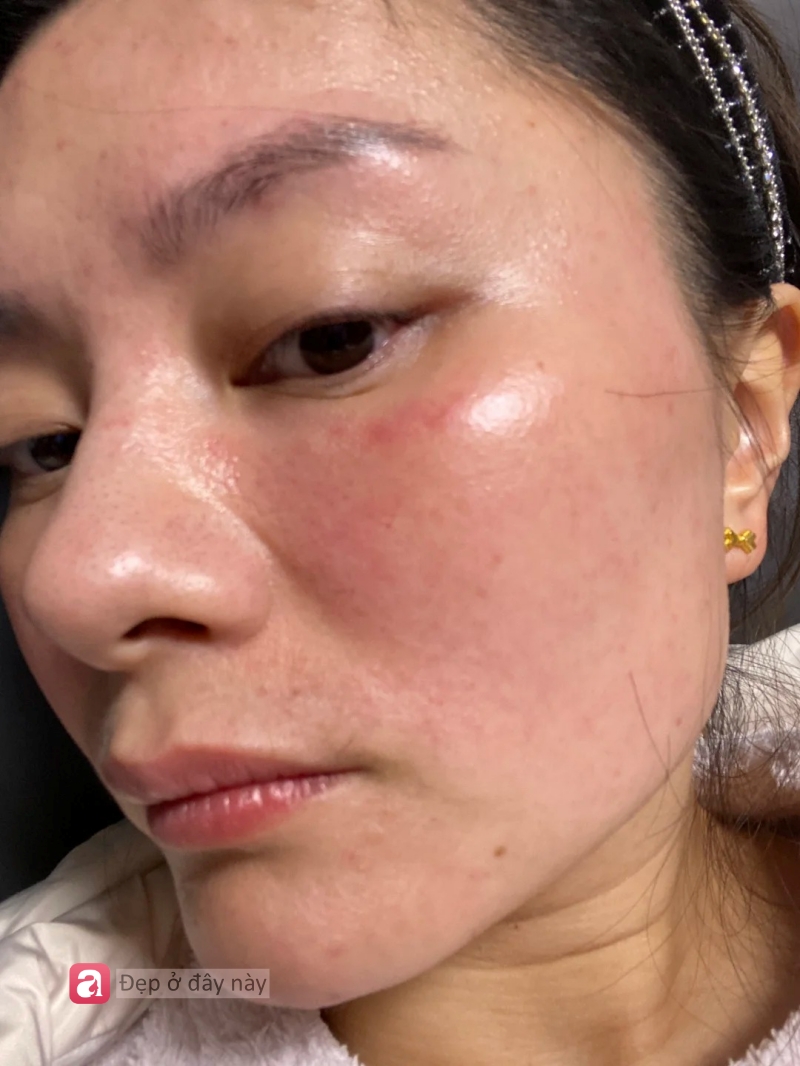 T&ocirc;i từng &ldquo;n&eacute;m tiền qua cửa sổ&rdquo; v&igrave; m&ecirc; spa, cho đến khi nhận ra: Chỉ cần 3 ph&uacute;t đắp lotion mỗi ng&agrave;y, da cũng c&oacute; thể đẹp l&ecirc;n- Ảnh 1.