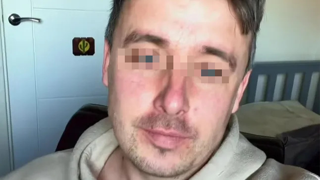 Ch&agrave;ng trai 26 tuổi phải cắt bỏ hơn 10cm "cậu nhỏ" v&igrave; bỏ qua 1 thứ ai cũng tưởng tắm... chưa kỹ - Ảnh 1.