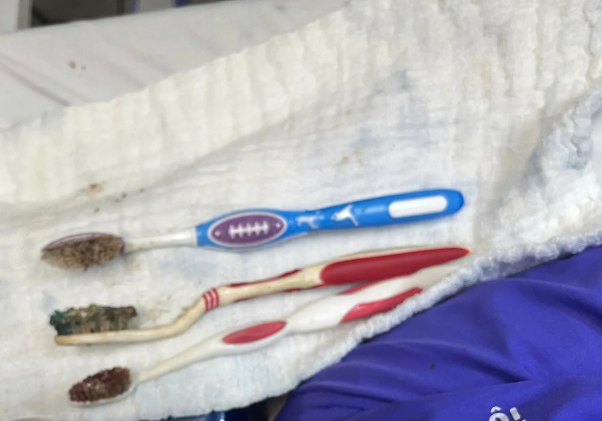 Nam thanh ni&ecirc;n 29 tuổi đau bụng, b&aacute;c sĩ lấy ra thứ "đ&aacute;ng sợ" trong cơ thể - Ảnh 1.