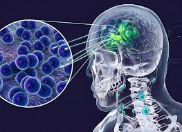 Th&ocirc;ng tin quan trọng li&ecirc;n quan ca dương t&iacute;nh vi&ecirc;m n&atilde;o m&ocirc; cầu ở C&agrave; Mau - Ảnh 1.