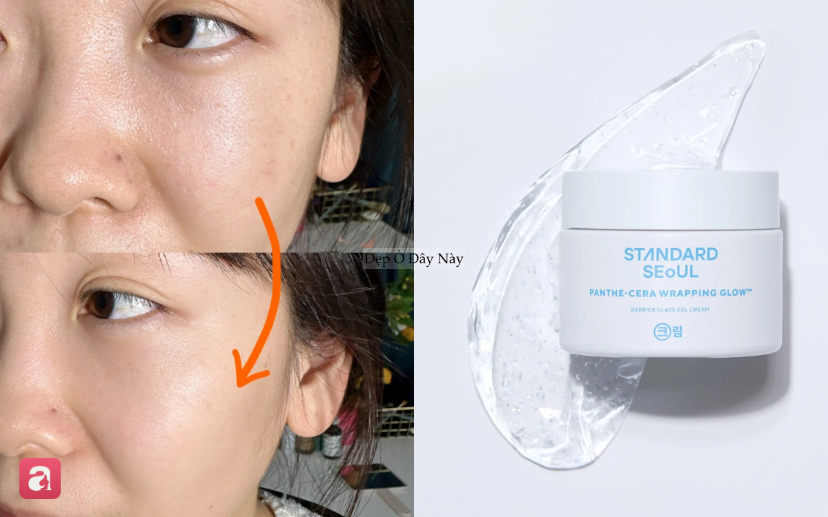 H&egrave; đến, 5 m&oacute;n skincare bạn n&ecirc;n đổi ngay để da kh&ocirc;ng "ngộp thở"- Ảnh 5.