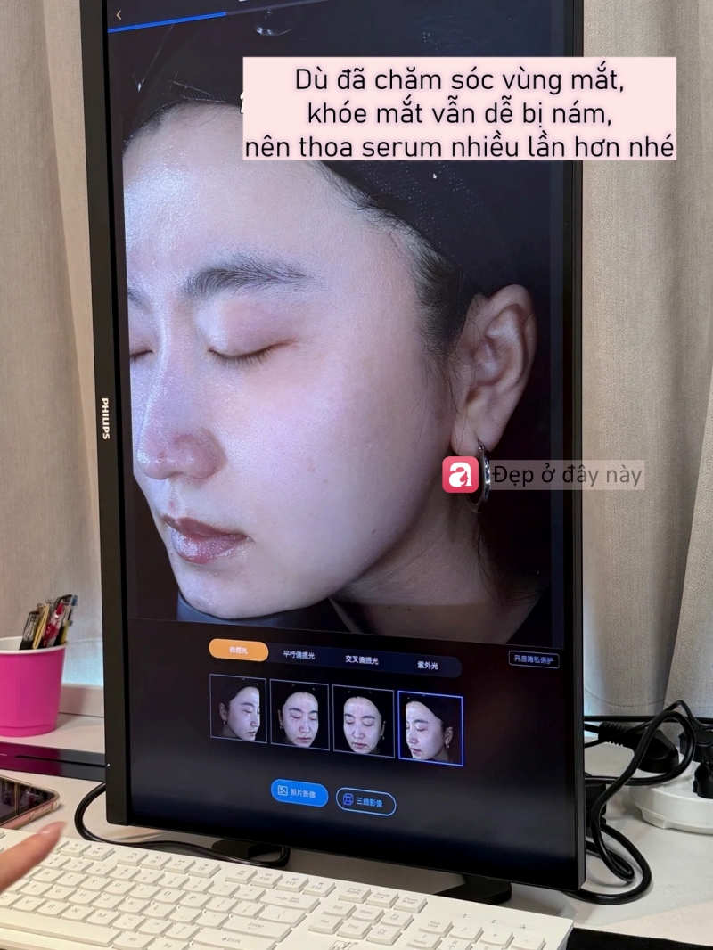 34 tuổi da lại đẹp hơn tuổi 20: B&iacute; quyết kh&ocirc;ng nằm ở mỹ phẩm đắt tiền m&agrave; ở 3 th&oacute;i quen n&agrave;y- Ảnh 5.