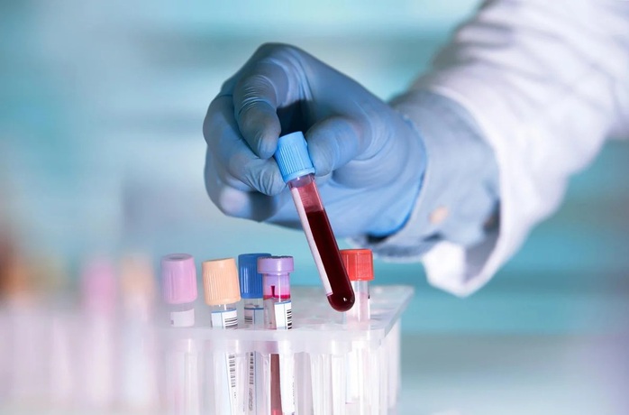  Mỹ ph&aacute;t triển x&eacute;t nghiệm ung thư gi&aacute; rẻ - Ảnh 1.