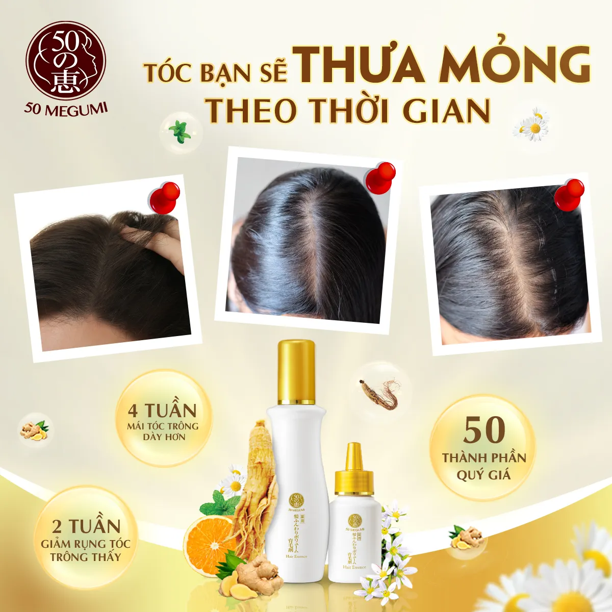 T&oacute;c rụng đến nỗi lộ cả mảng da đầu, t&ocirc;i quyết định theo 5 quy tắc chăm s&oacute;c sau để t&oacute;c đen d&agrave;y trở lại- Ảnh 8.