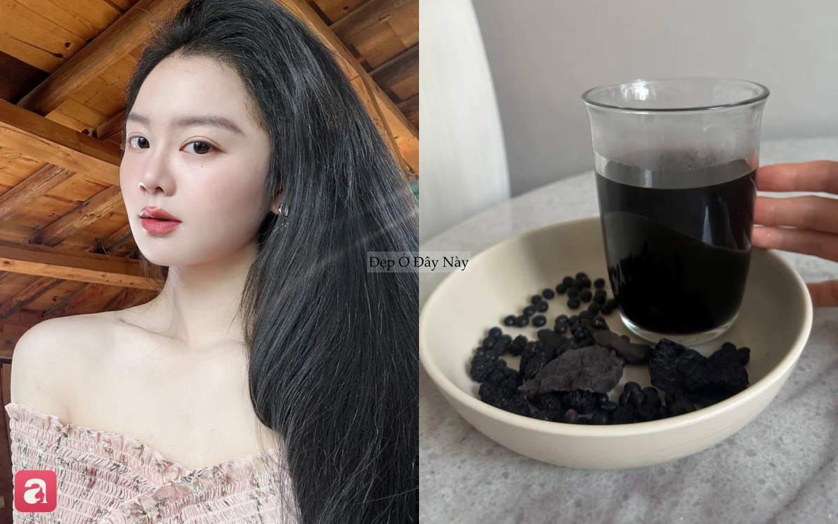 T&oacute;c rụng đến nỗi lộ cả mảng da đầu, t&ocirc;i quyết định theo 5 quy tắc chăm s&oacute;c sau để t&oacute;c đen d&agrave;y trở lại- Ảnh 2.