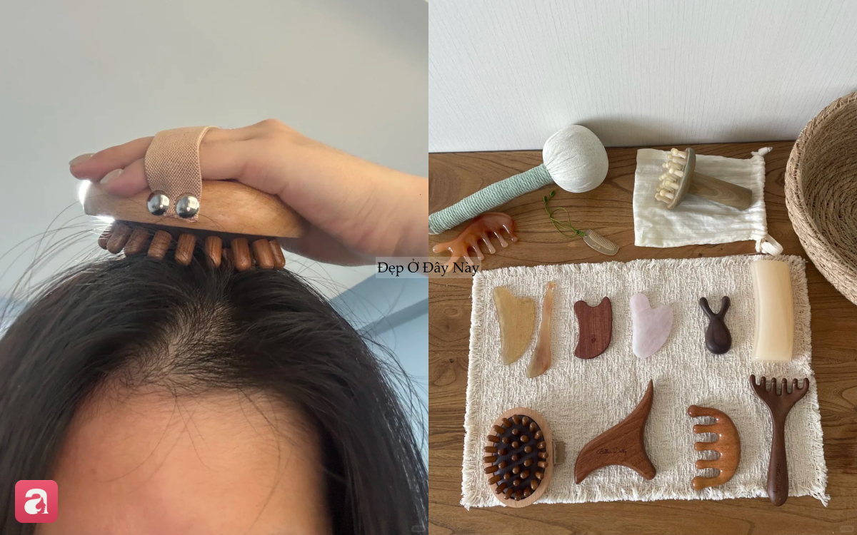 T&oacute;c rụng đến nỗi lộ cả mảng da đầu, t&ocirc;i quyết định theo 5 quy tắc chăm s&oacute;c sau để t&oacute;c đen d&agrave;y trở lại- Ảnh 4.