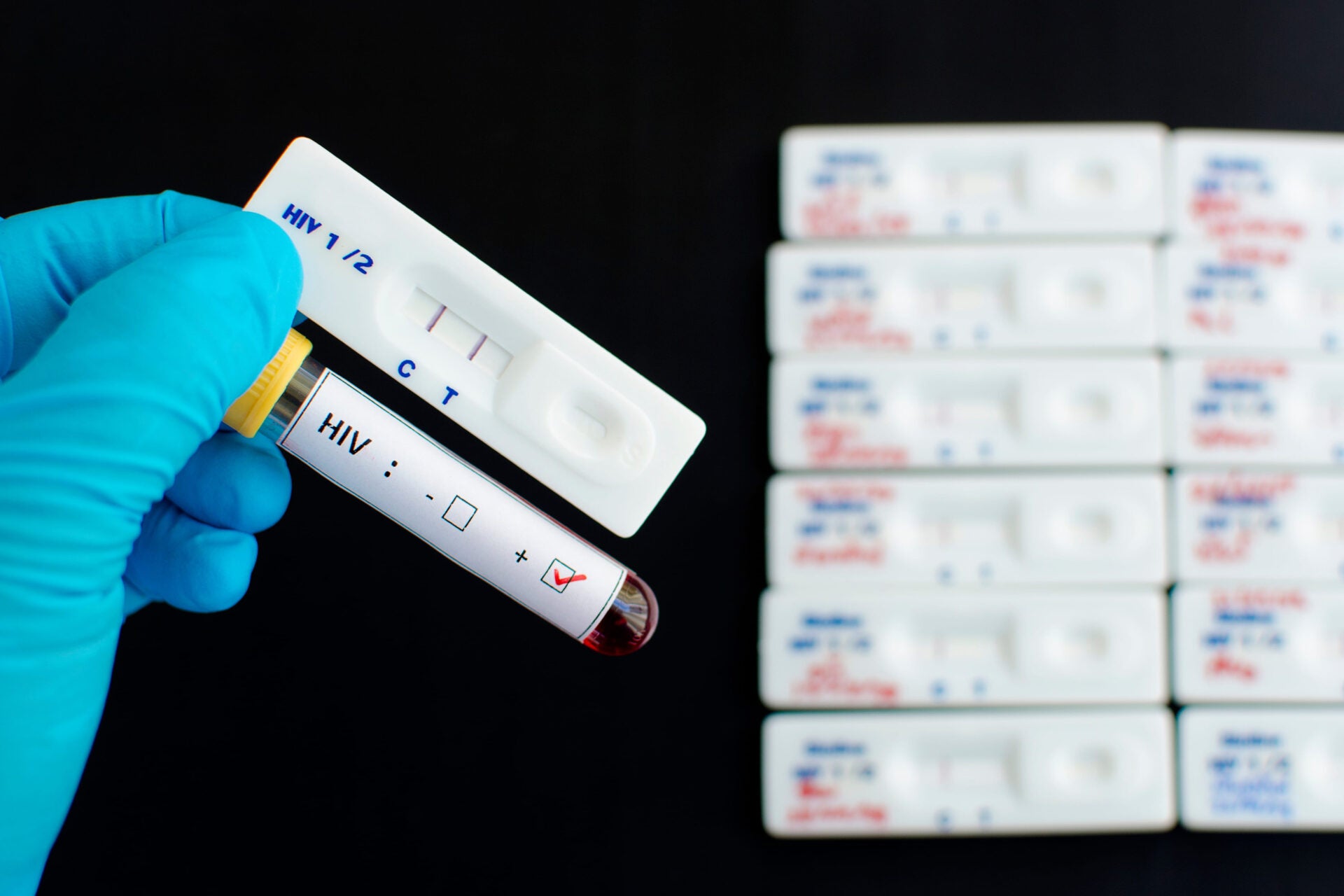 Vợ bị nhiễm HIV sau khi chồng đi "ăn vụng" ở b&ecirc;n ngo&agrave;i rồi ngỡ ng&agrave;ng trước lời biện minh của đối phương- Ảnh 1.