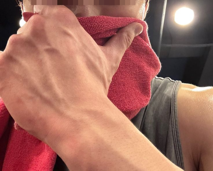 Ch&agrave;ng trai ngo&agrave;i 20 tuổi bị s&ugrave;i m&agrave;o g&agrave; khẳng định chưa từng l&agrave;m "chuyện ấy", b&aacute;c sĩ tiết lộ "b&iacute; mật" từ ph&ograve;ng tập gym- Ảnh 3.