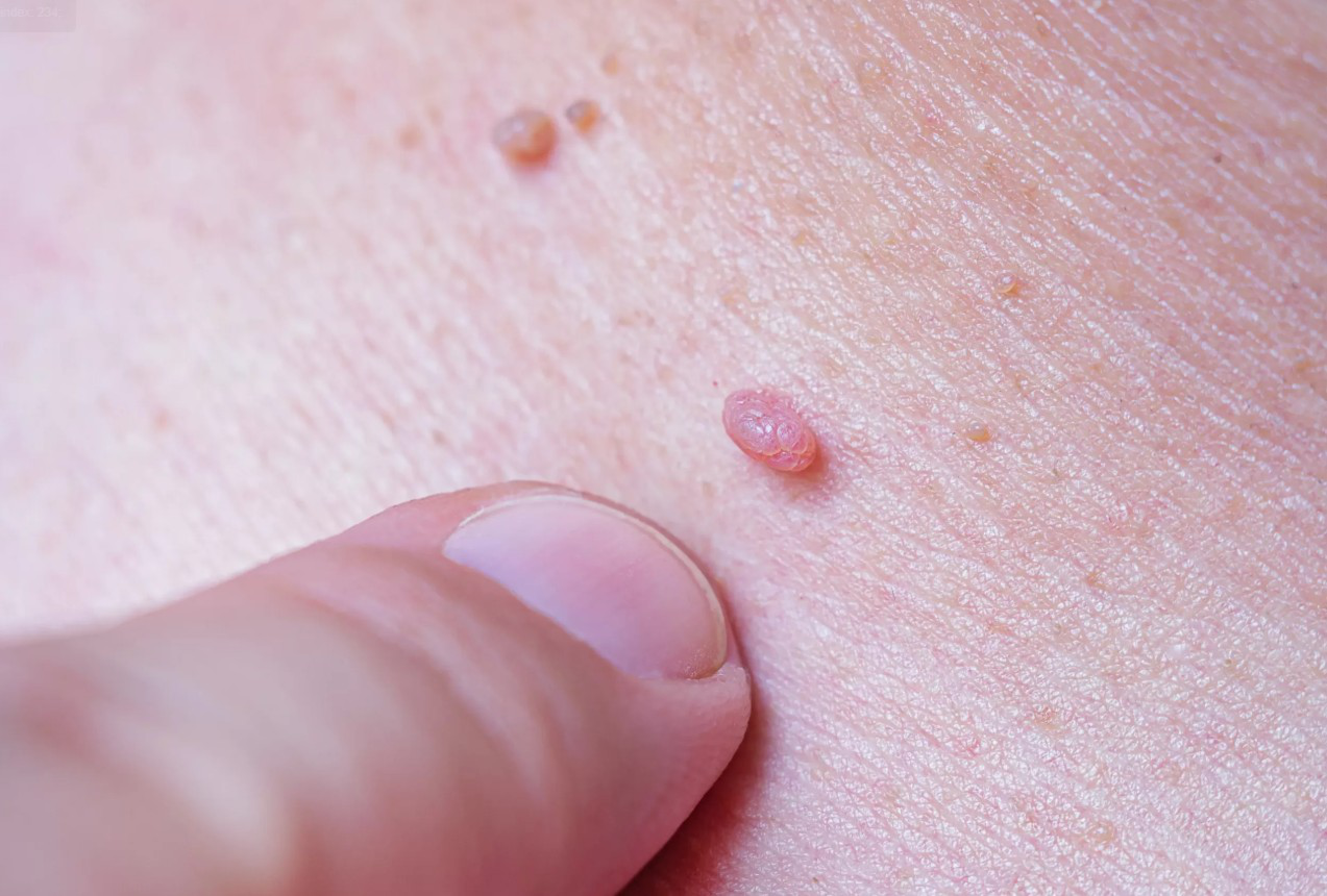 Phụ nữ từng quan hệ t&igrave;nh dục n&ecirc;n biết- Ảnh 1.