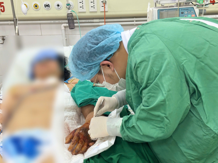 Vi khuẩn 'ăn m&ograve;n' b&agrave;n tay sau mũi ti&ecirc;m, người phụ nữ su&yacute;t mất mạng- Ảnh 1.