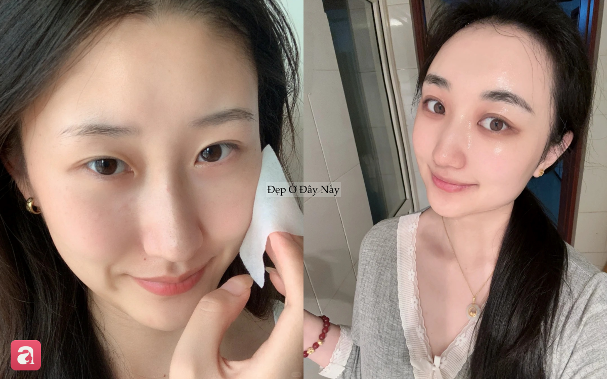 Da đẹp l&ecirc;n chỉ sau 1 đ&ecirc;m kh&ocirc;ng phải chuyện kh&oacute;, quan trọng l&agrave; tu&acirc;n thủ đủ 5 quy tắc sau- Ảnh 1.