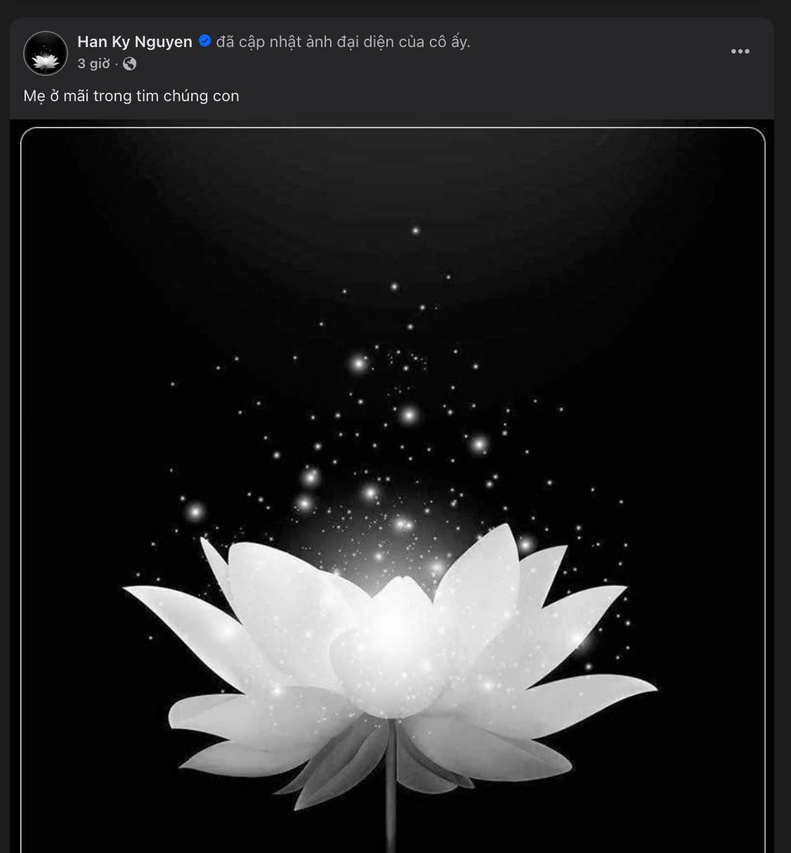 Mất m&aacute;t lớn của người mẫu Kỳ H&acirc;n- Ảnh 1.