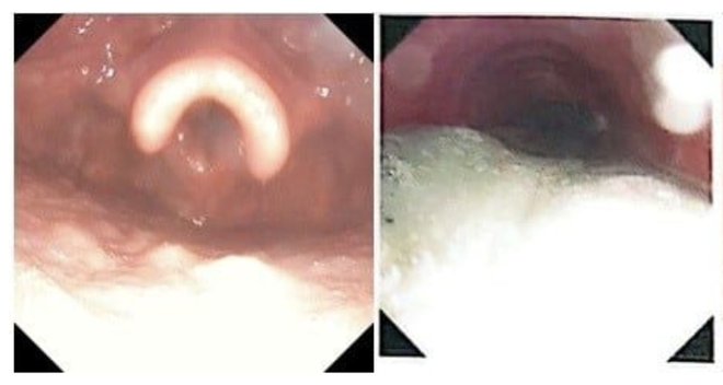 Ngạt kh&oacute;i nặng sau vụ ch&aacute;y, đ&ocirc;i vợ chồng trẻ được hồi sinh kỳ diệu  - Ảnh 2.