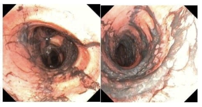 Ngạt kh&oacute;i nặng sau vụ ch&aacute;y, đ&ocirc;i vợ chồng trẻ được hồi sinh kỳ diệu  - Ảnh 1.