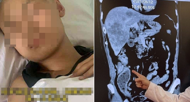 58 người sốt cao, ti&ecirc;u chảy nhập viện cấp cứu, thủ phạm đến từ 1 thứ trong bếp mọi gia đ&igrave;nh, rửa đi rửa lại vẫn đầy vi khuẩn - Ảnh 3.